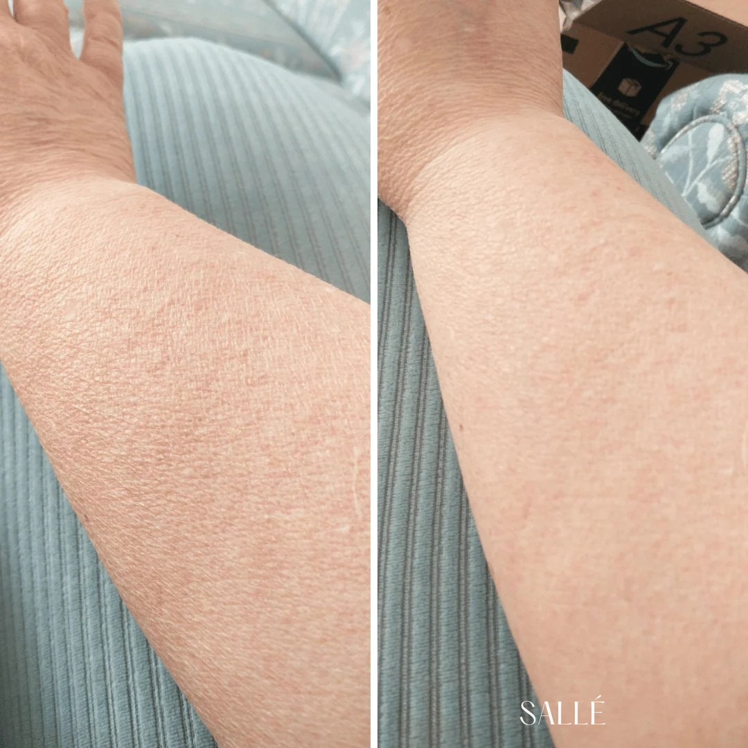 SALLÉ Crepey Skin Repair Treatment