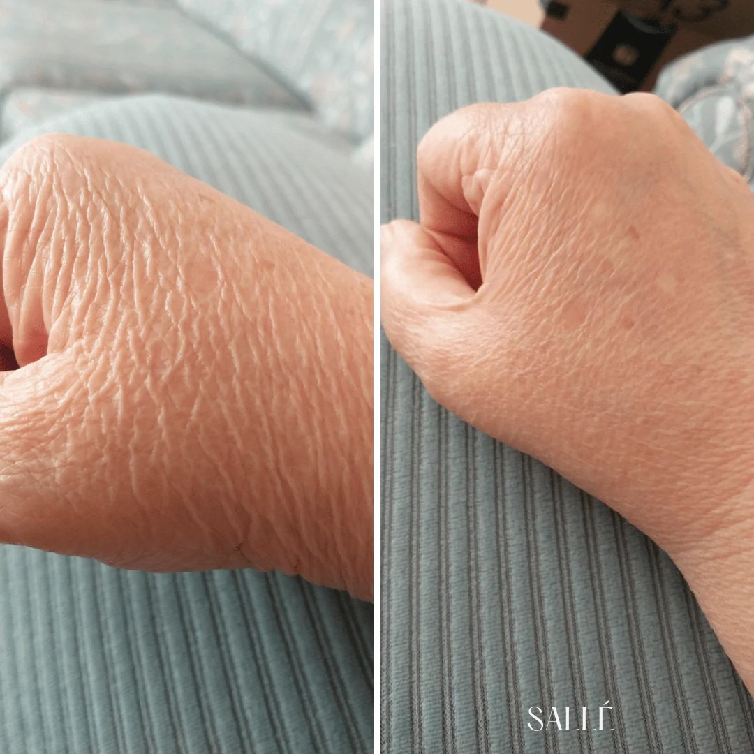 SALLÉ Crepey Skin Repair Treatment